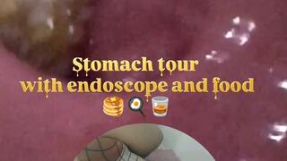 Stomach tour with endoscope and food (Complete point of view)