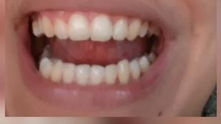 Admire the imperfections of our teeth