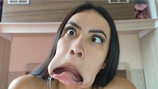 Grimaces with a lip retractor