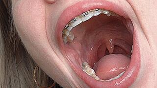 A giant throat and a big mouth! MP4