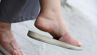 Slippers dangling, cracked heels, foot fetish admiratrion