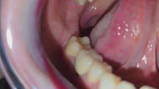 Tour of my mouth with retractor 8K