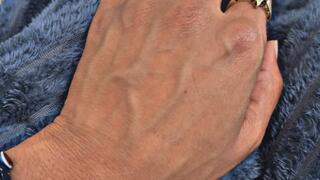 Slow Motion, No Distractions — Close Enough to Catch Every Vein