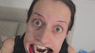 Wide Open Eyes and Dental Mouth Spreader 8K