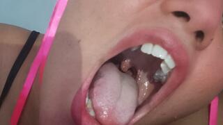 My uvula, your temptation