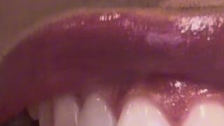 GUMMY BEAR SLAUGHTER