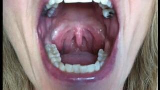 PLAYFUL UVULA