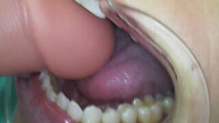 Using the cheek retractors, I bite the dildo crushing it showing with endoscope.