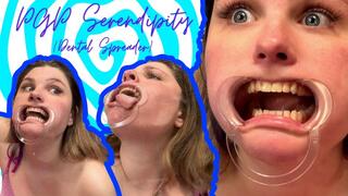 Plexiglass Princess Serendipity Dental Spreader