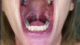 IS THERE A DENTIST IN THE HOUSE?