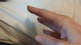 Fifi getting each of her fingers bitten one by one and showing off the deep teeth marks