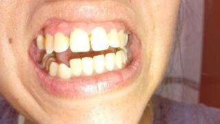 Lola's dirty, defective mouth