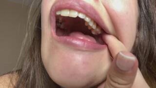 Dental Mirror Deep in My Mouth – Extreme Close-Up Teeth Inspection POV