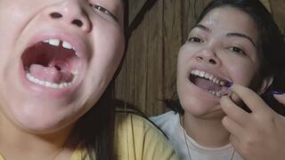 Yellow and ugly teeth like never before