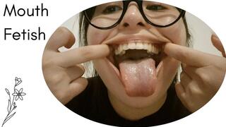 Inspecting my mouth and my crooked teeth