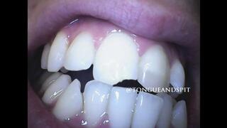 Aaron Teeth Endoscope Part17 Video1 - WMV