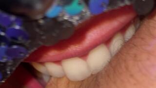 Leaving bitemarks in arm