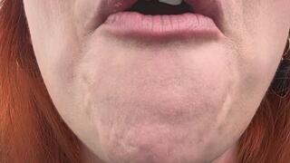 Sorry About Your Home