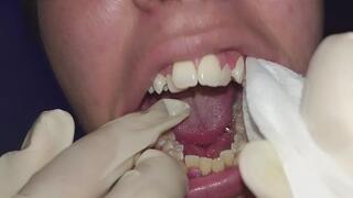 Cleaning my teeth with a wet towel (close-up)