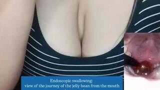 Endoscopic swallowing: view of the journey of the jelly bean from the mouth to the stomach