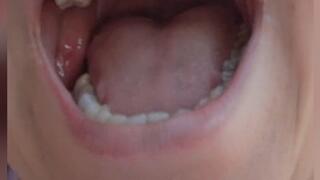 They show us the imperfections of their teeth