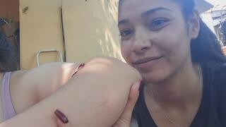 They enjoy biting me