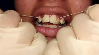 Using dental floss (close-up) Natural teeth