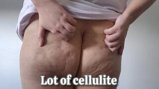 My Dimpled Cellulite Ass Jiggles While I Scratch My Bouncy Booty