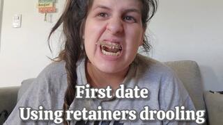 First Date Disaster with Retainers - Lisp Talking, Drooling Saliva Everywhere & They Keep Falling Out POV