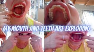 Examining my teeth