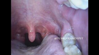 Logan Endoscope Mouth Part21 Video1 - MP4