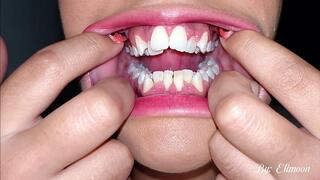 Do you like the sound of teeth chattering? Enjoy it up close. Teeth chewing (high quality)