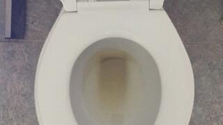 I PEE GOLD INSIDE MY TOILET