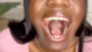 Whipped Cream Spitting