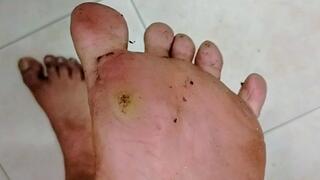 Extremely Dirty Unwashed Work Feet Before Shower – Filthy Sweaty Soles Close-Up
