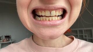 Teeth and mouth fetish!