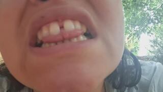 “Jugando con Mi Boca: Dientes, Úvula y Locura”
