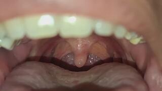 The beauty of my uvula