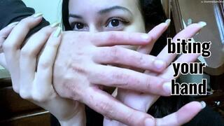 Many bites on the fingers and hand