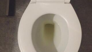 I PISS GOLD IN MY TOILET =)