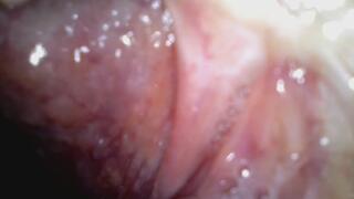 Holy uvula Endoscope camera used