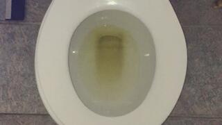 I PEE GOLD IN MY TOILET MSN THE ZONE