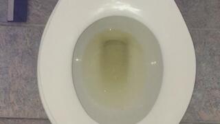 I PEE GOLD IN MY TOILET POV