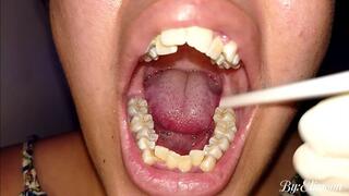 10 days without brushing my teeth. Dirty teeth and lots of saliva? Of course!