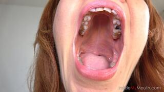Redhead Titi's Extreme Mouth Tour – Huge Lips, Missing Tooth & Dancing Uvula (FULLHD resolution)
