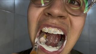 Close-Up:My mouth in full view. Whispers and Foam