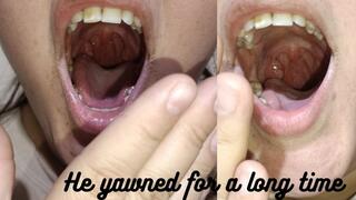 He yawned in the foreground