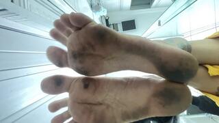 feet after walking barefoot on the street.