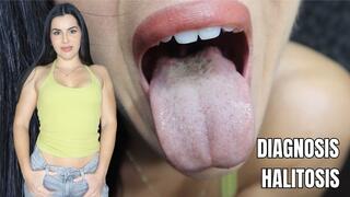 Diagnosis: halitosis - OnlyVanessa (custom clip)