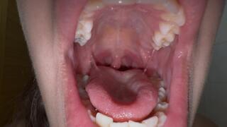 Deep Mouth View Uvula and Teeth Close-Up